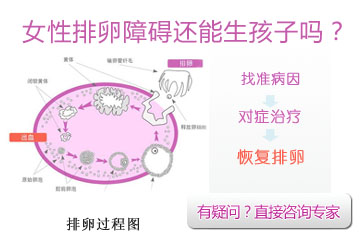 排卵障碍