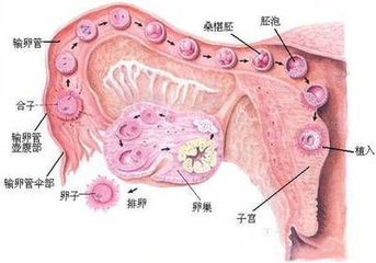 多囊卵巢综合症